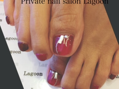 Gallery Foot Nail